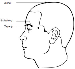 Visage-Pt.Rhume 2